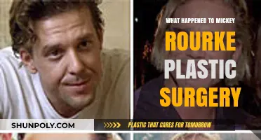 Mickey Rourke's Plastic Surgery: The Shocking Transformation and Aftermath