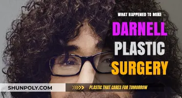 Mike Darnell's Plastic Surgery: Unraveling the Transformation and Aftermath