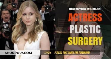 Starlight Actress Plastic Surgery: Transformation, Rumors, and Truth Revealed