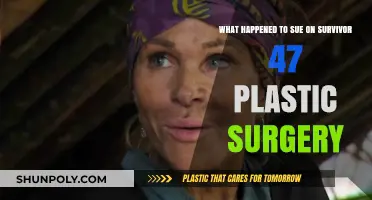Survivor 47's Sue: Plastic Surgery Transformation Explained