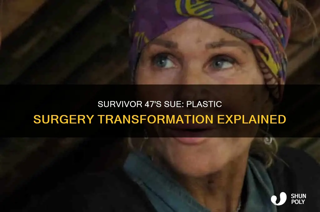 what happened to sue on survivor 47 plastic surgery