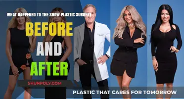 Plastic Surgery Before and After: The Show's Disappearance Explained