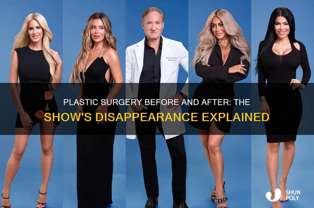what happened to the show plastic surgery before and after