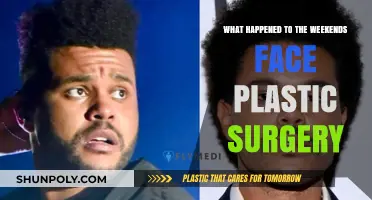 Weekend's Face Transformation: Uncovering Plastic Surgery Speculations and Truths
