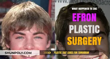 Zac Efron's Plastic Surgery: Unraveling the Truth Behind His Transformation
