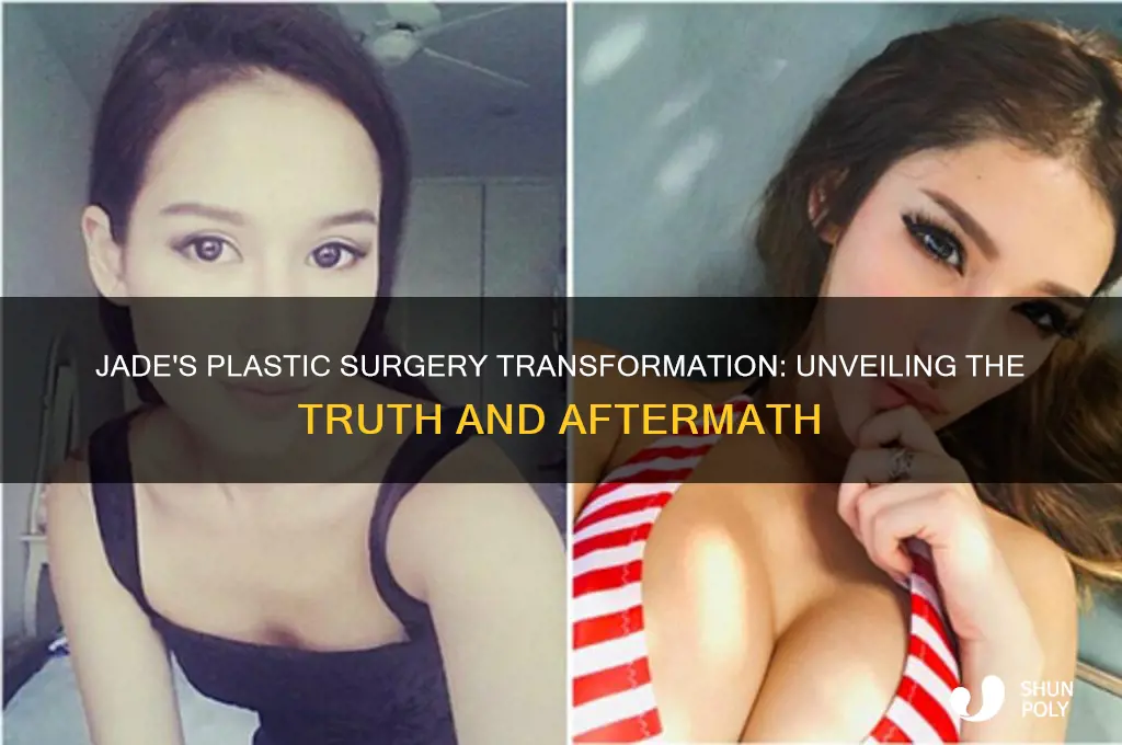 what happened with jade plastic surgery