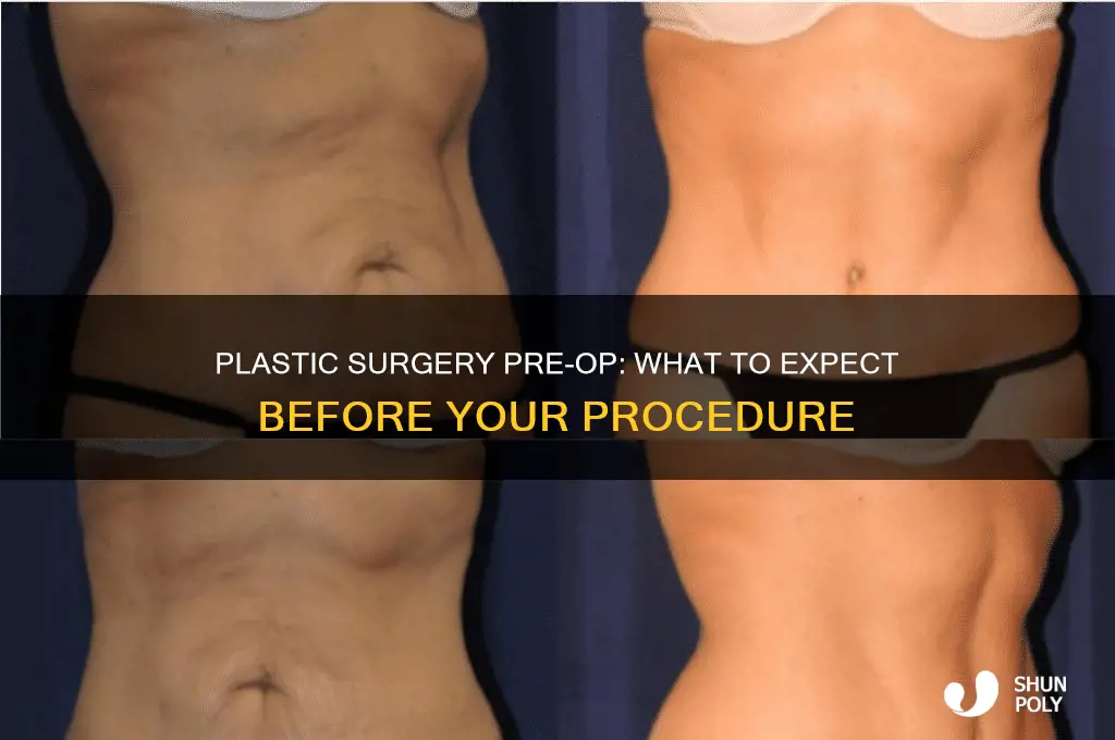 what happens at a plastic surgery pre op