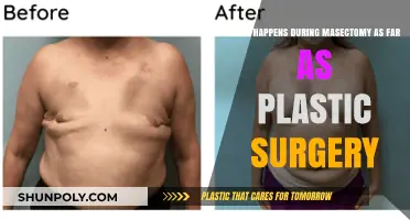 Mastectomy and Plastic Surgery: Understanding the Reconstruction Process