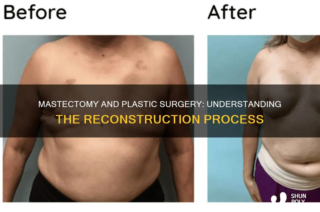 what happens during masectomy as far as plastic surgery