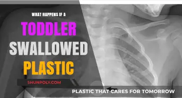 Toddler Swallows Plastic: What Parents Need to Know