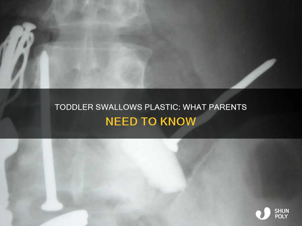 what happens if a toddler swallowed plastic