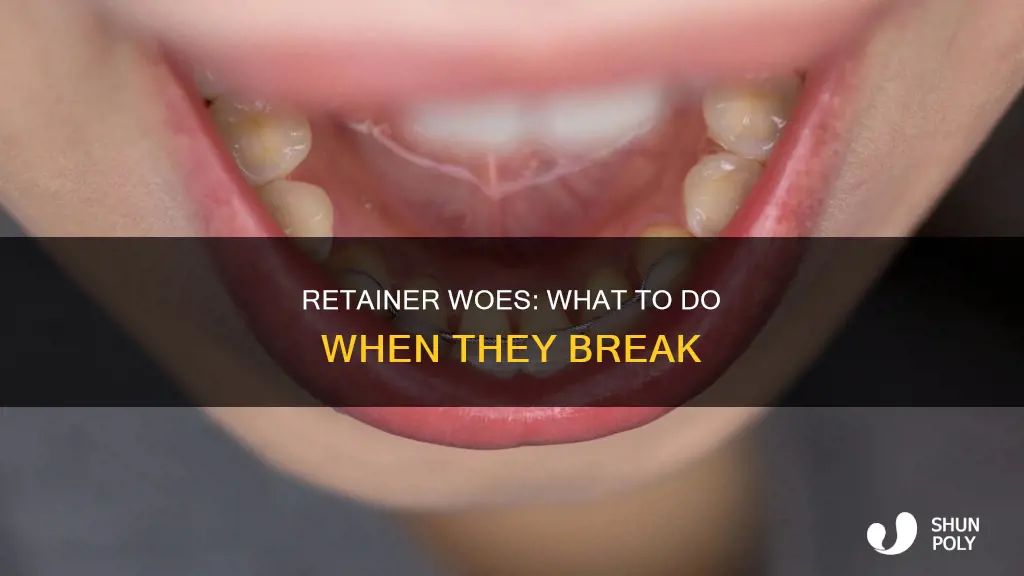 what happens if my plastic retainers break