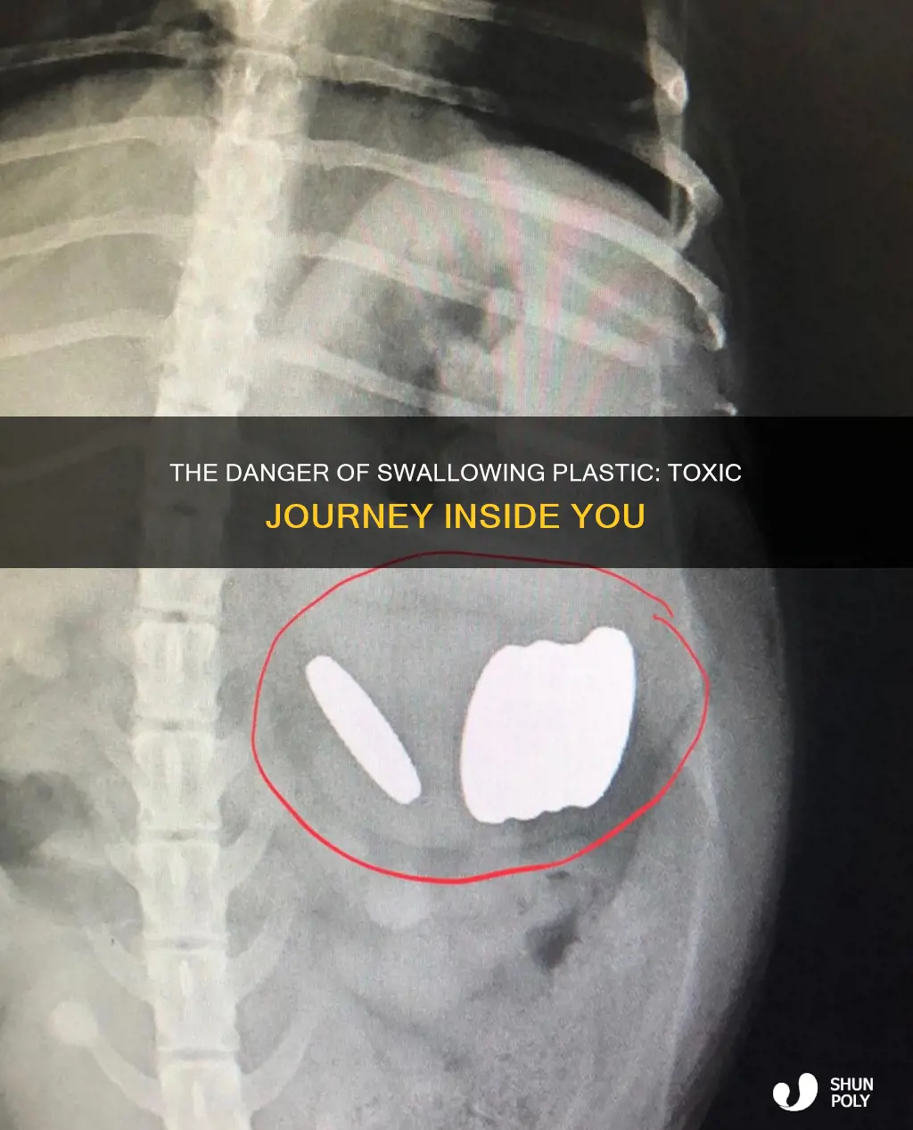 what happens if you swallow plastic