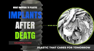 The Mystery of Plastic Implants After Death