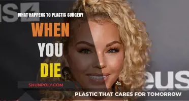 Plastic Surgery's Fate: What Happens to Enhancements After Death?