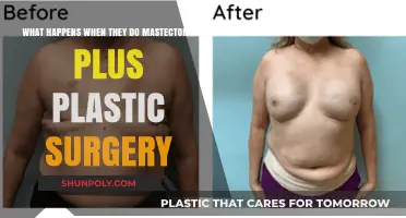 Mastectomy and Plastic Surgery: Transforming Bodies, Rebuilding Confidence Post-Surgery