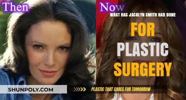 Jacklyn Smith's Plastic Surgery Journey: Procedures and Transformations Revealed