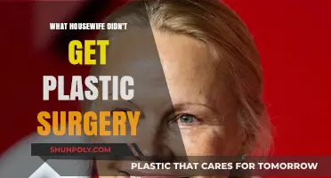 Natural Beauty: Housewives Who Skipped Plastic Surgery and Embraced Authenticity
