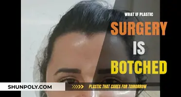 Botched Plastic Surgery: Risks, Realities, and Recovery Options Explained