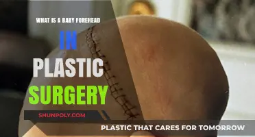 Understanding Baby Forehead Plastic Surgery: Techniques, Benefits, and Considerations