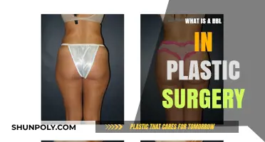Understanding BBL: Brazilian Butt Lift Explained in Plastic Surgery