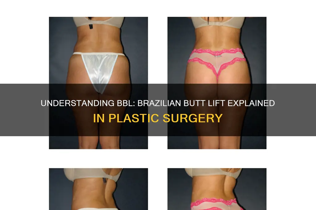 what is a bbl in plastic surgery