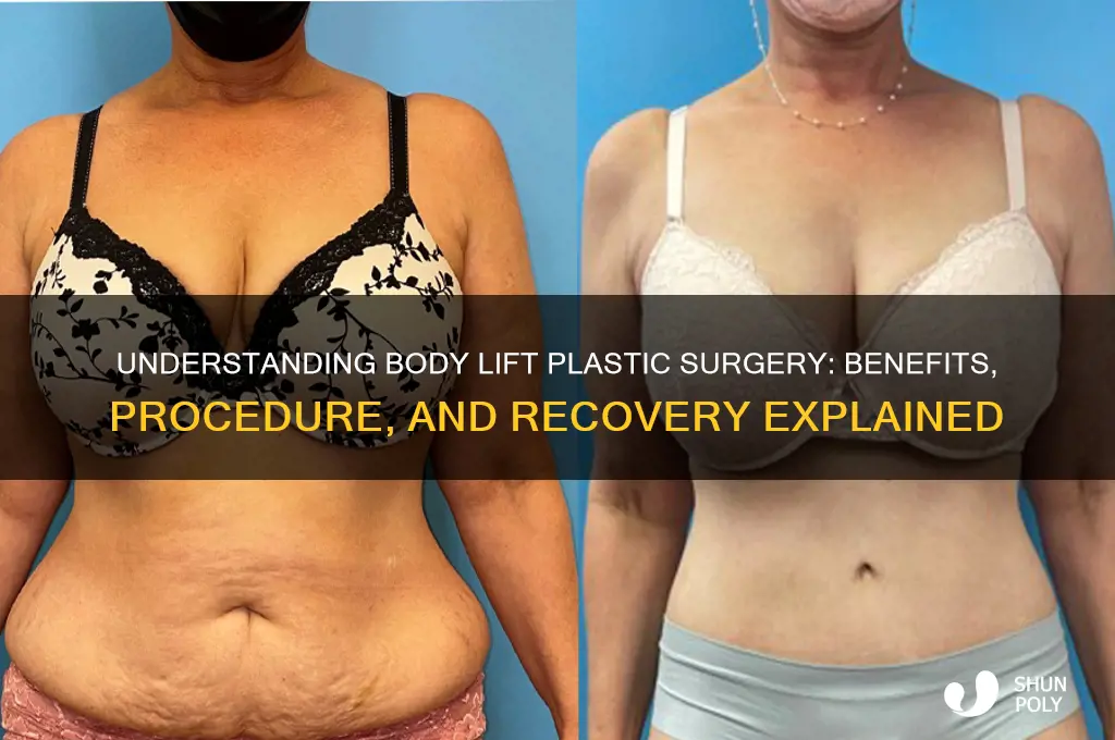what is a body lift plastic surgery