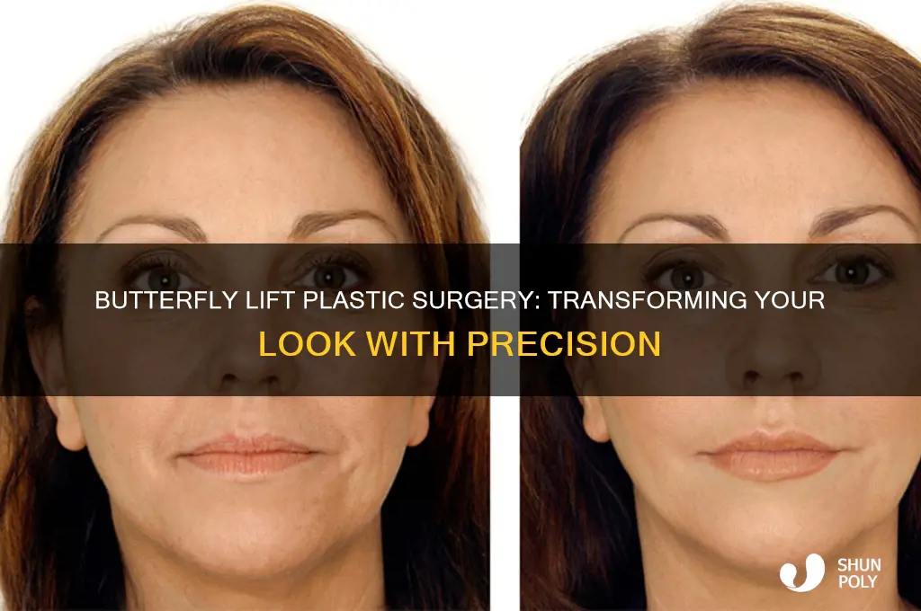 what is a butterfly lift plastic surgery