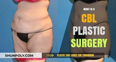 Understanding CBL Plastic Surgery: Procedure, Benefits, and Recovery Explained