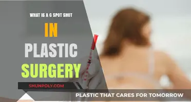 Understanding the G Spot Shot: A Plastic Surgery Enhancement Explained