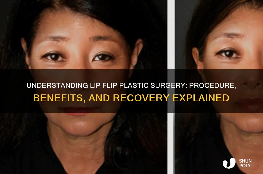 what is a lip flip plastic surgery