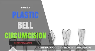 Plastic Bell Circumcision: A Safe and Effective Procedure