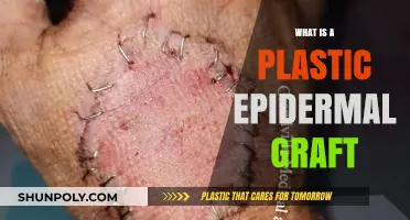 Plastic Epidermal Grafts: Transforming Skin Treatments