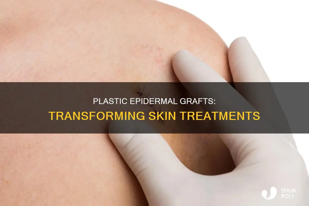 what is a plastic epidermal graft