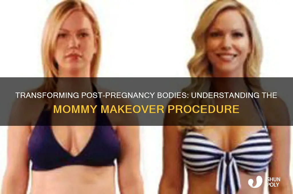 what is a plastic surgery mommy makeover
