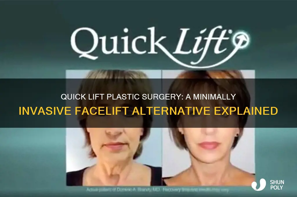 Quick Lift Plastic Surgery A Minimally Invasive Facelift Alternative