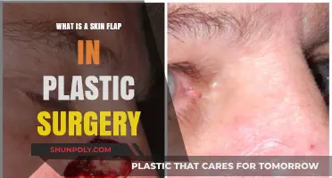 Understanding Skin Flaps: Essential Techniques in Plastic Surgery Explained