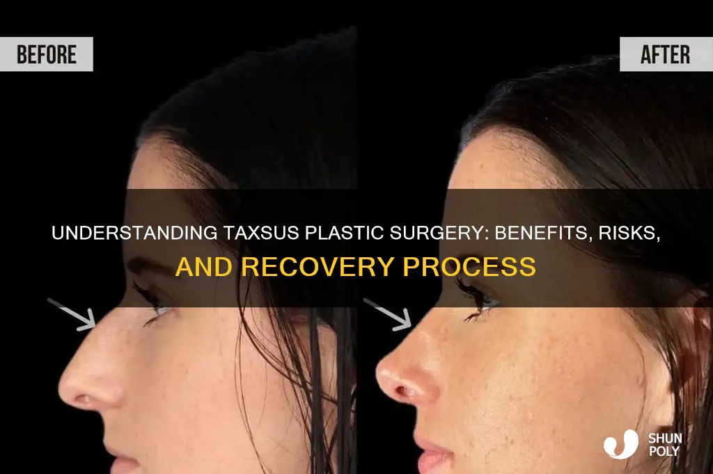 what is a taxsus plastic surgery