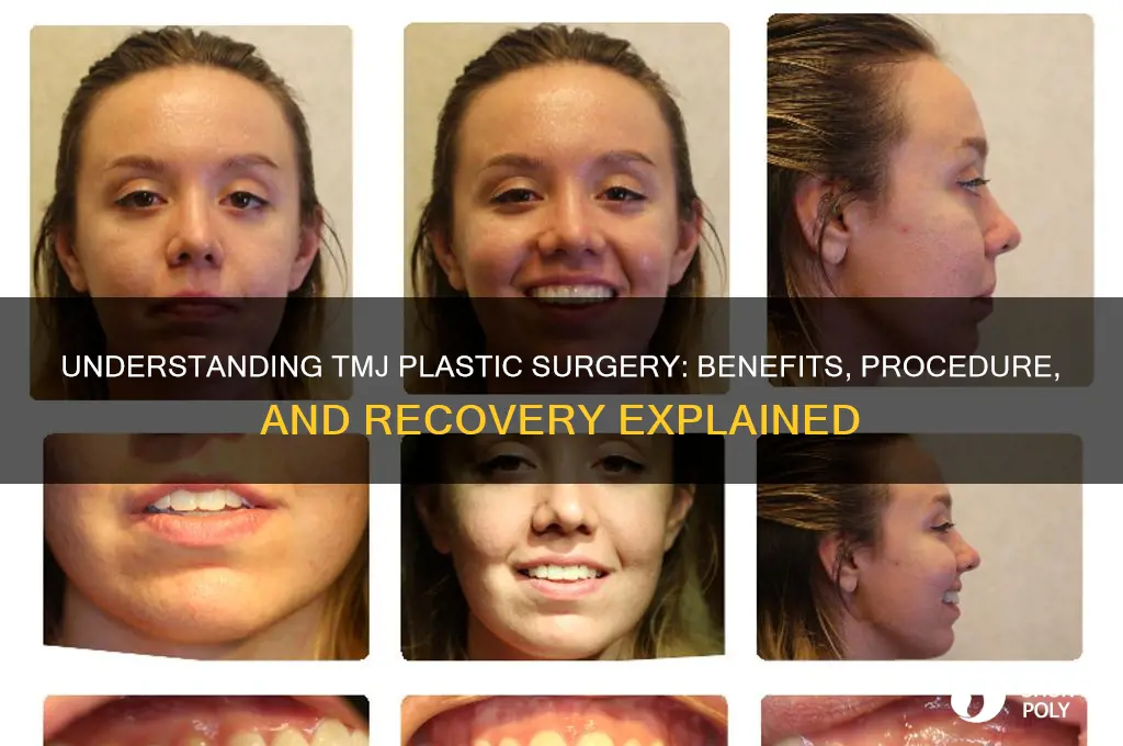 what is a tmj plastic surgery