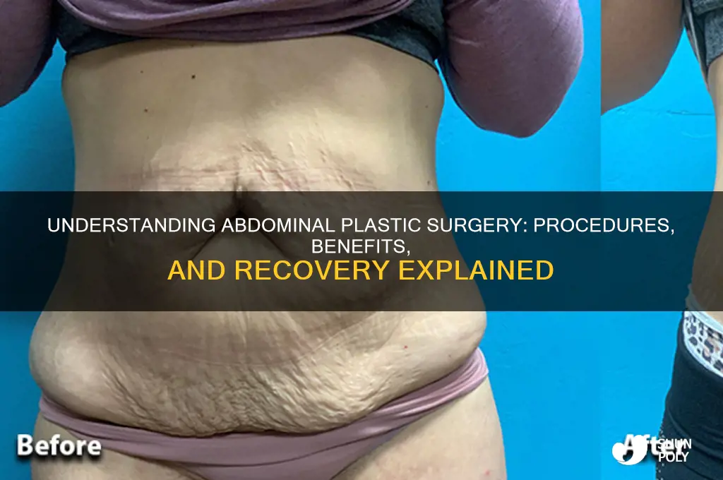 what is abdominal plastic surgery