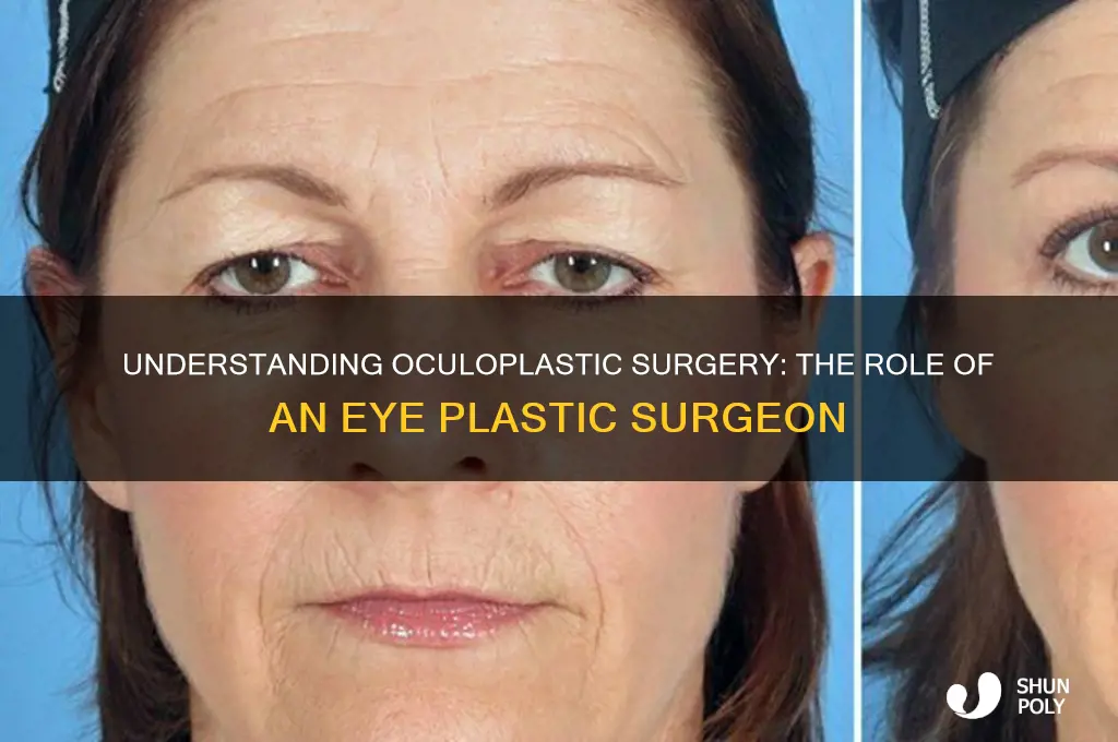 what is an eye plastic surgeon called
