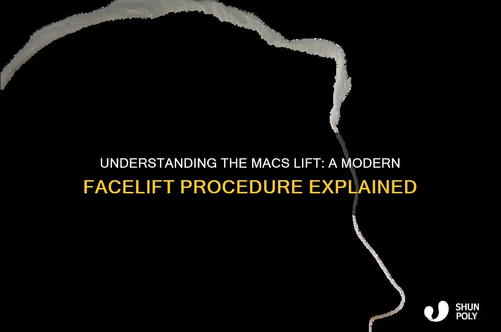 what is an macs lift plastic surgery