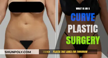 Understanding S Curve Plastic Surgery: Transforming Body Contours with Precision