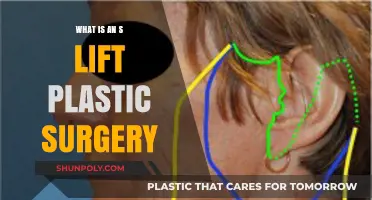 Understanding the S Lift: A Minimally Invasive Facelift Alternative