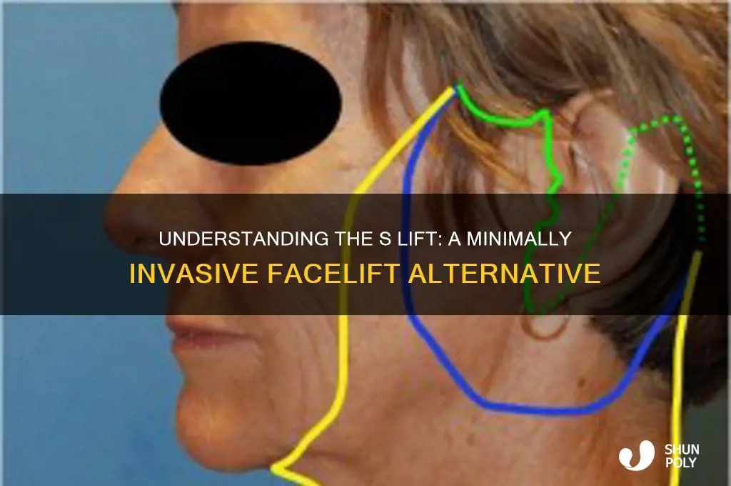 what is an s lift plastic surgery