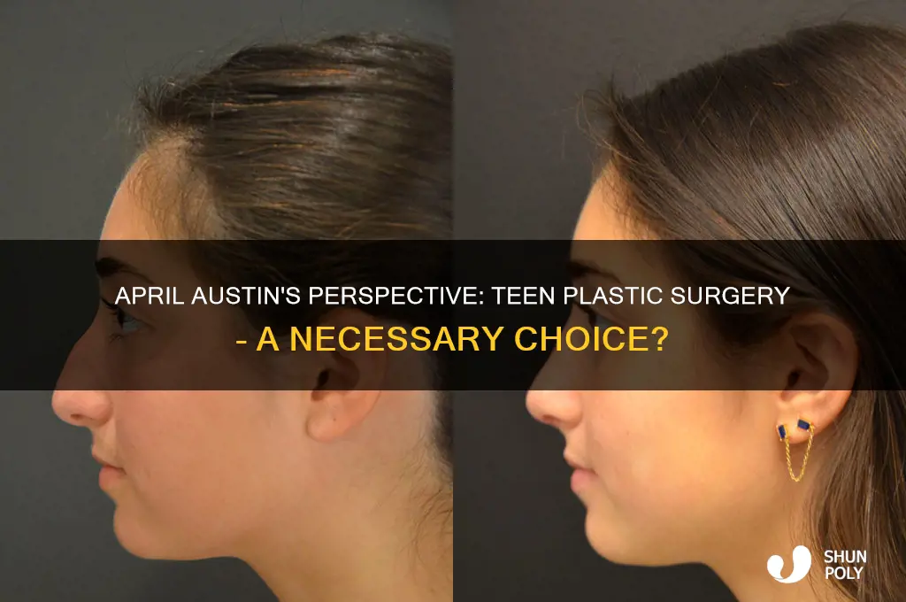 what is april austins stance on plastic surgery for teens