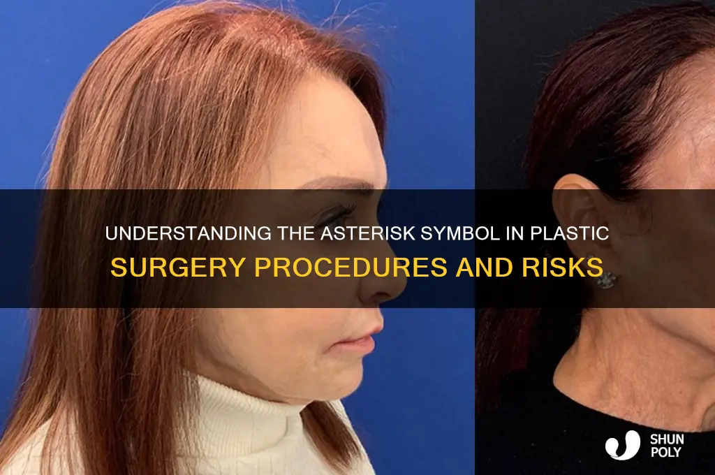 what is asterisk in plastic surgery