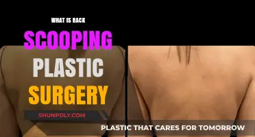 Understanding Back Scooping Plastic Surgery: Procedure, Benefits, and Recovery
