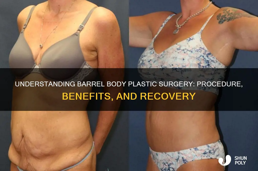 what is barrel body plastic surgery