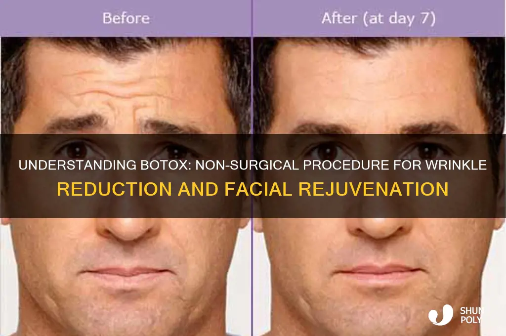 what is botox plastic surgery